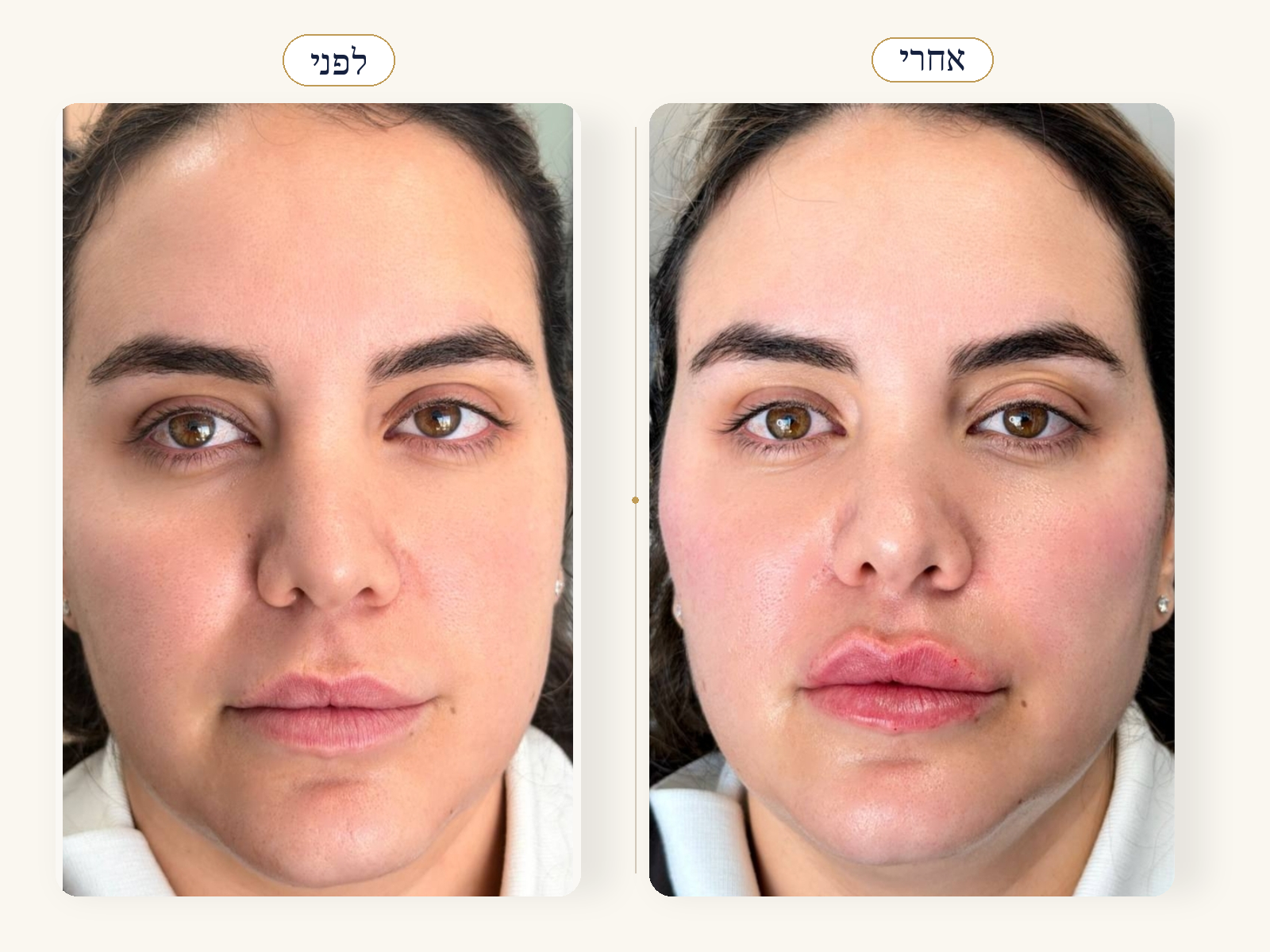 עיצוב שפתיים טבעי ועדין